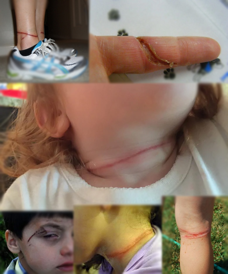 Flexi-povodac-za-pse